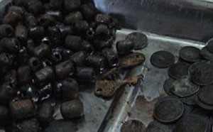 کشف عجیب 431 سکه در معده یک هندی!!! +عکس