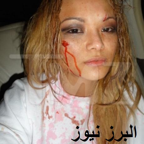 حمله به خواننده معروف و مجروح کردن وی +تصاویر