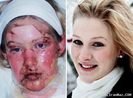 اتفاق باور نکردنی برای دختر 19 ساله و  زیبا!! +تصاویر ، www.irannaz.com