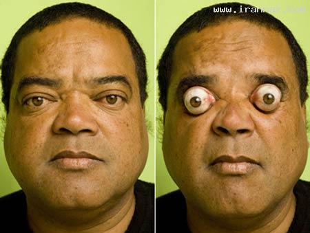 مردی با عجیب و جالب ترین چشم های جهان +عکس  1